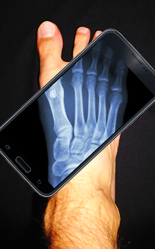 How To Boot In Android Recovery Mode Ubergizmo